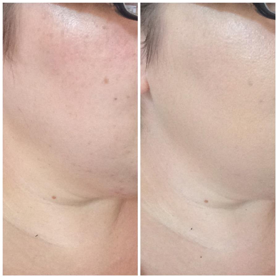 Foundation Stipple Brush, before foundation and after application - msmoomakeup.com